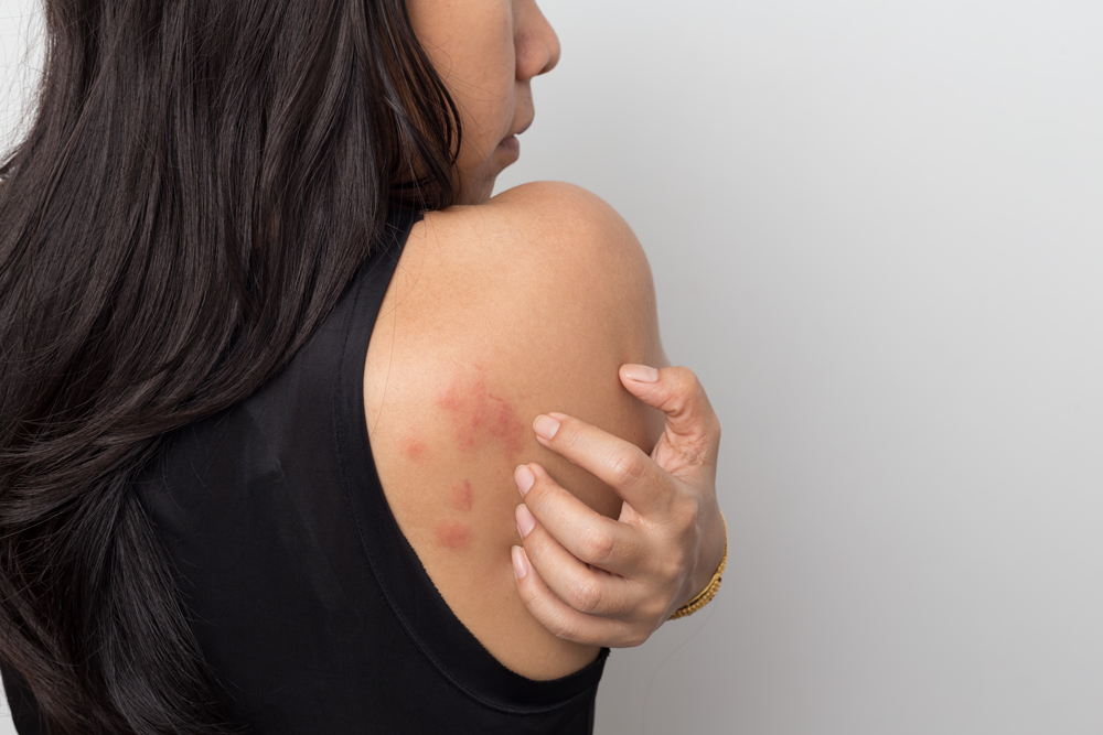 skin allergies
