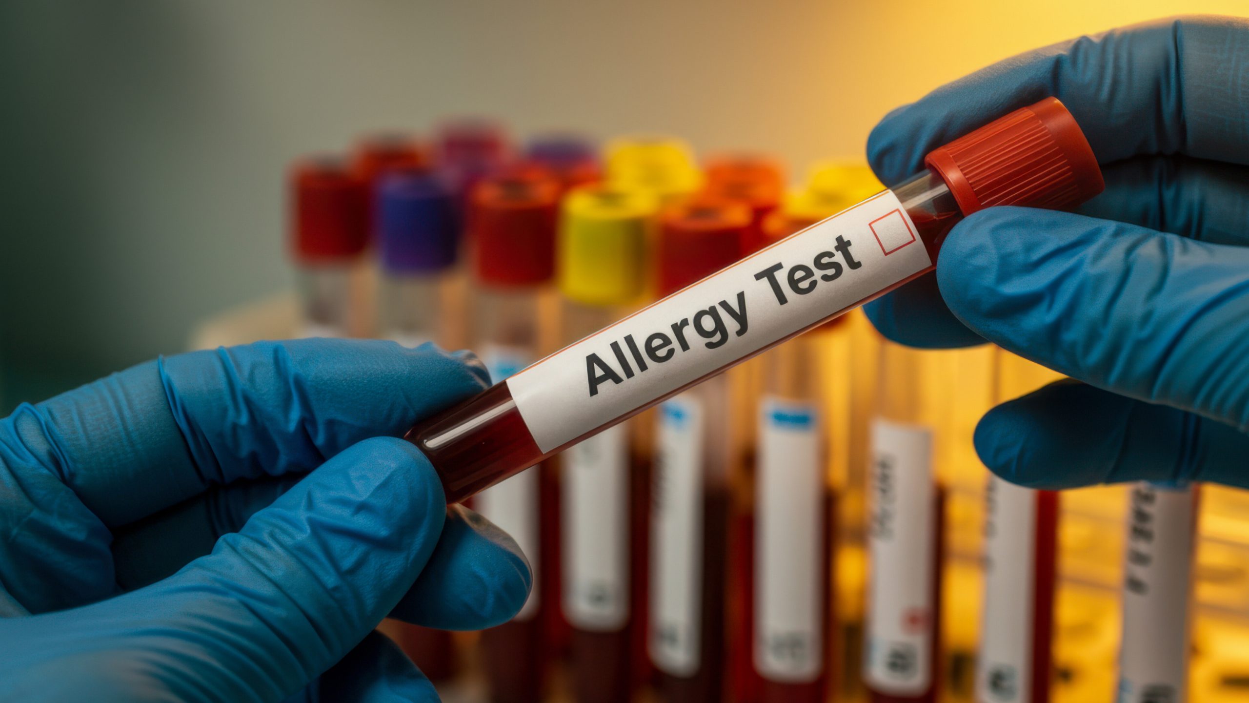 Allergy Testing & Shots